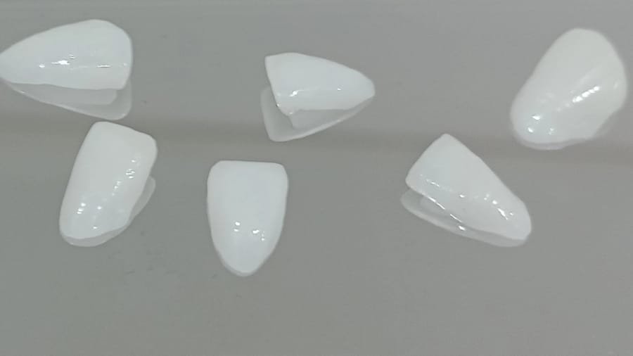 Lentes de porcelana sob medida