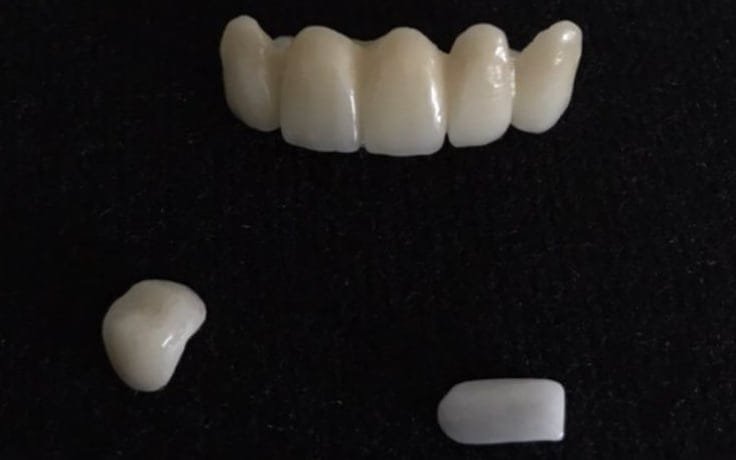 Próteses dentárias em porcelana